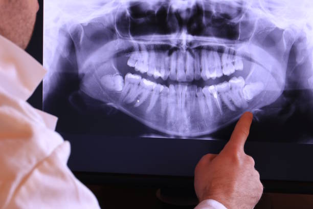 Best Broken or Cracked Tooth Emergency Dentist in , SC